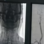 medicfeature00032