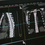 medicfeature00045