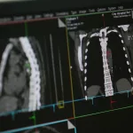 medicfeature00046